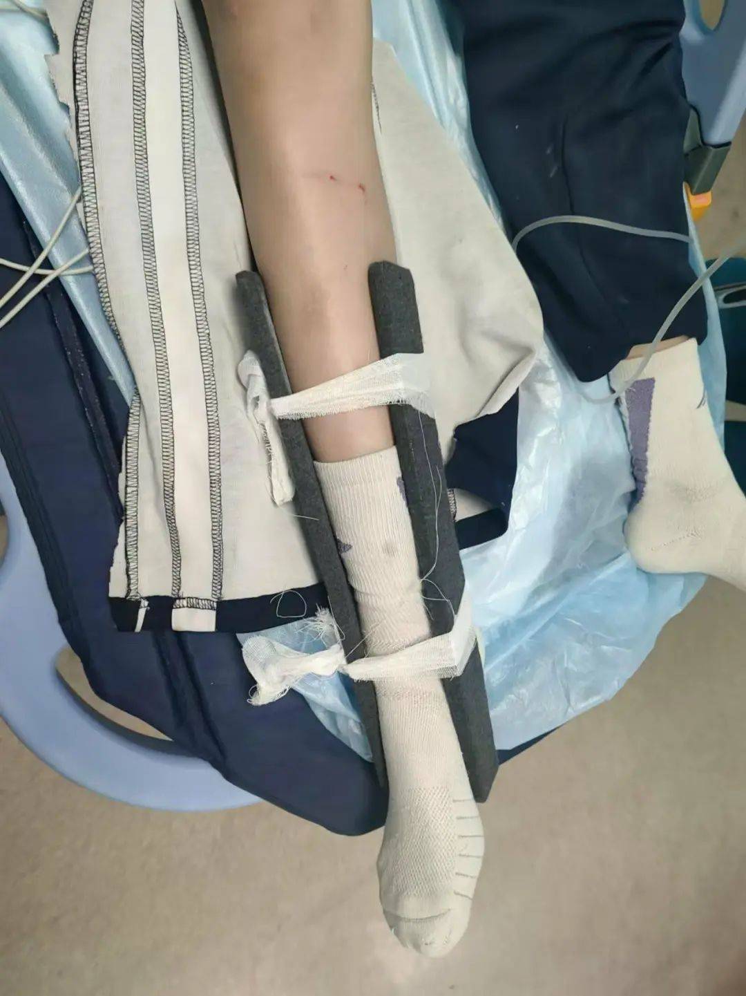 慘痛！一人身亡！深圳多名學(xué)生騎電動車發(fā)生意外