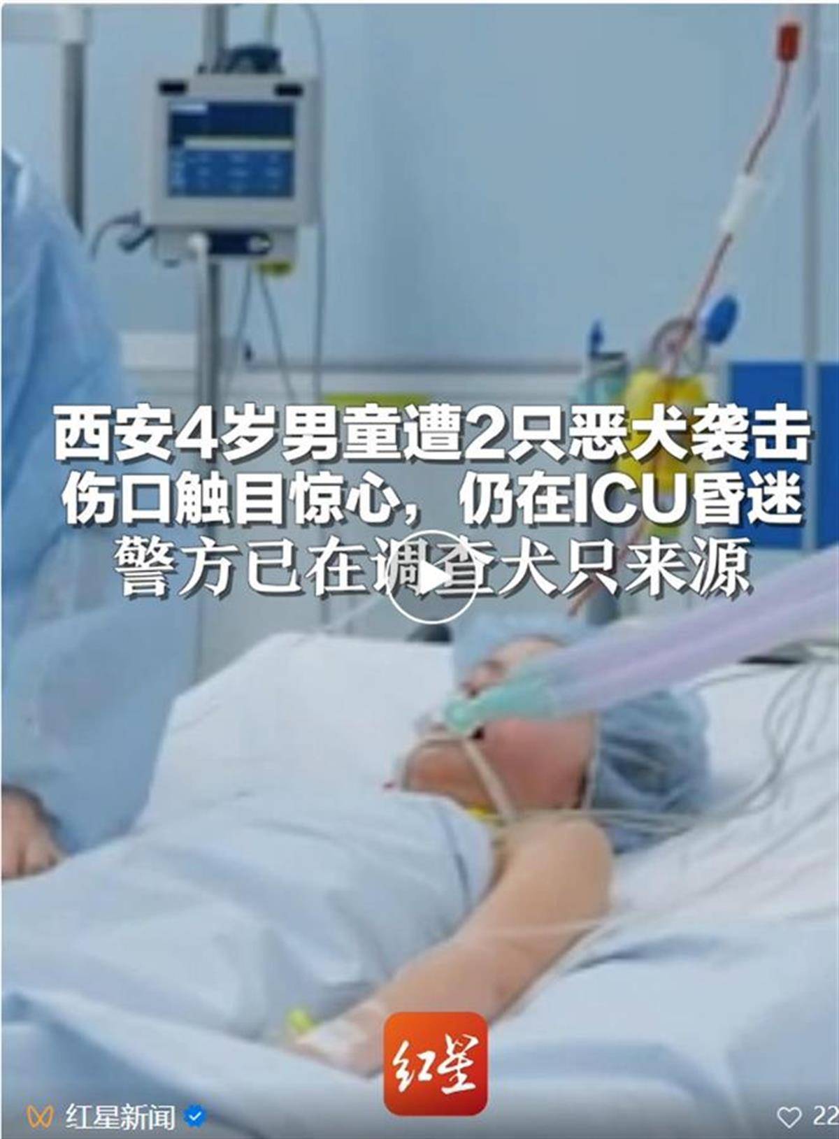 4歲男童遭惡犬襲擊住進(jìn)ICU，狗咬人為何就管不??？