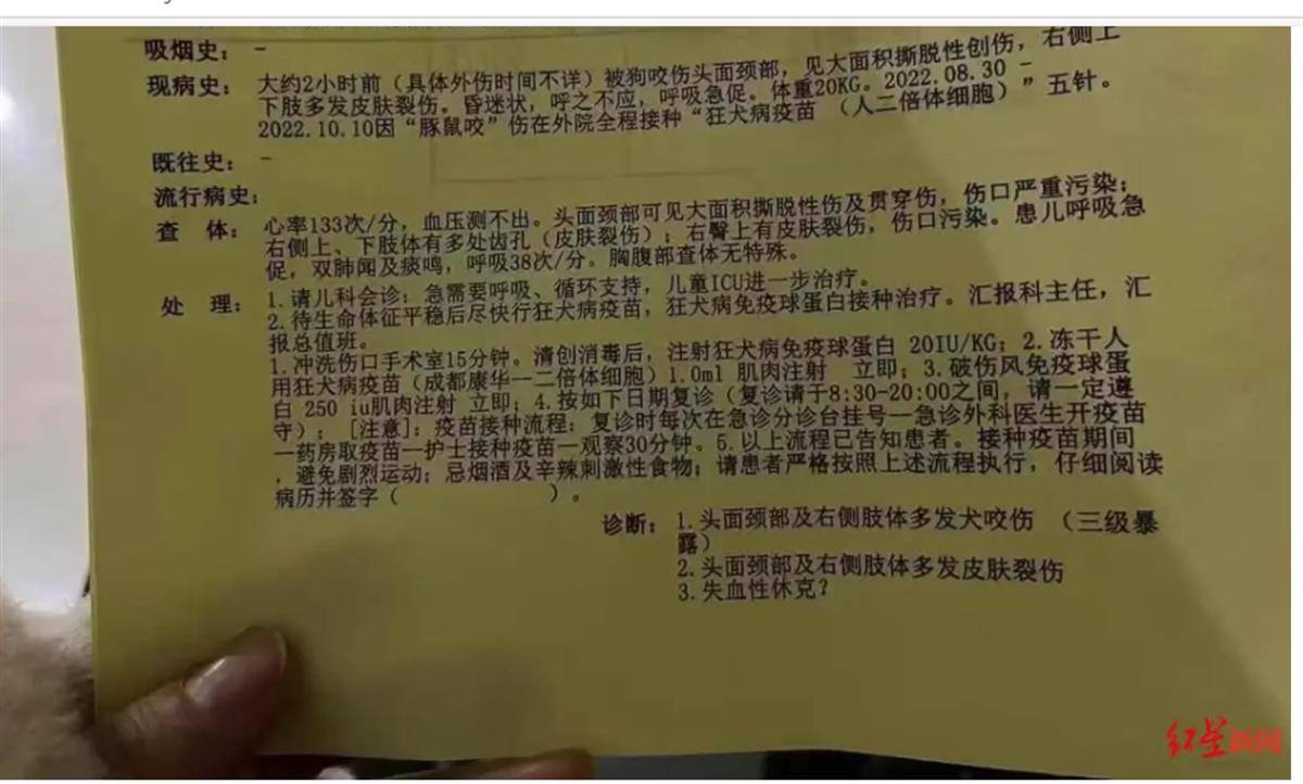 4歲男童遭惡犬襲擊住進(jìn)ICU，狗咬人為何就管不??？
