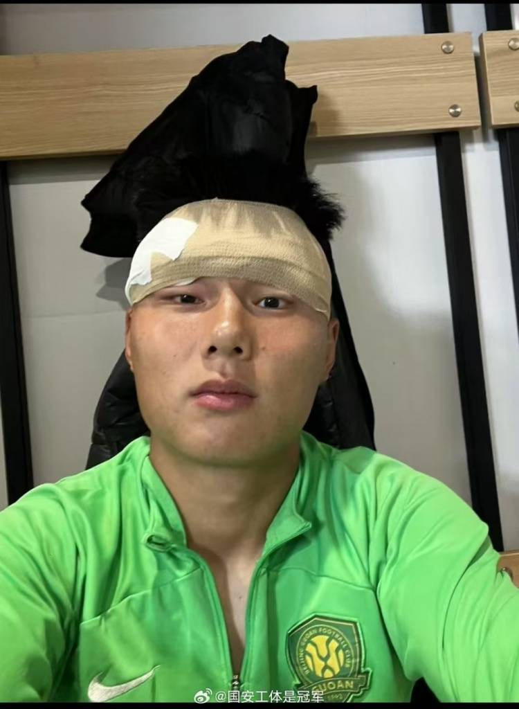 博主：國安冬訓(xùn)強(qiáng)度夠激烈，方昊訓(xùn)練場掛彩頭纏繃帶