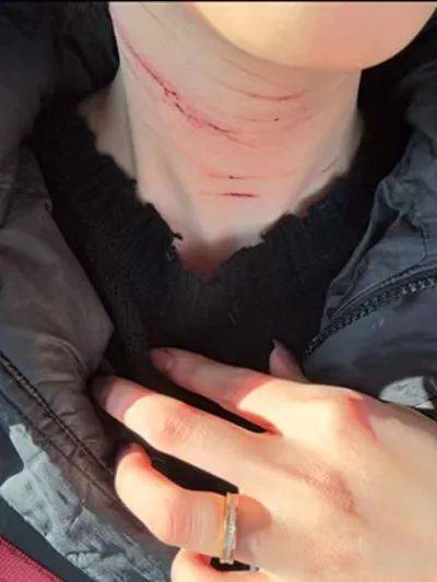 前男友公開金賽綸自殘照，稱她的死與金秀賢無關(guān)