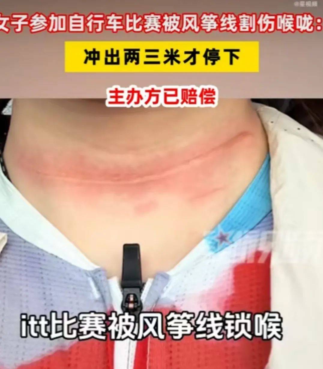 騎友在成都環(huán)城綠道險(xiǎn)遭“割頭”！春季騎行，警惕空中“致命風(fēng)箏線”