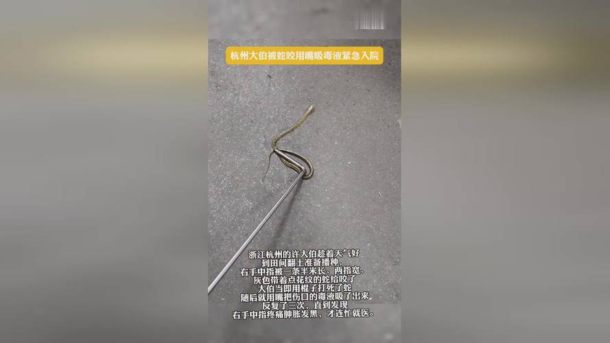 杭州大伯野外被蛇咬，用嘴吸毒液后緊急入院的驚險(xiǎn)事件
