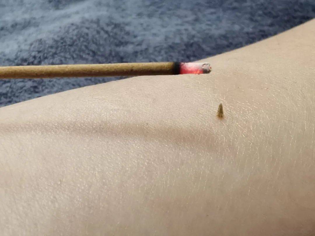醒來“天塌了”！深圳一女子眼睛閉不上、嘴巴漏水！這些錯誤很多人會犯