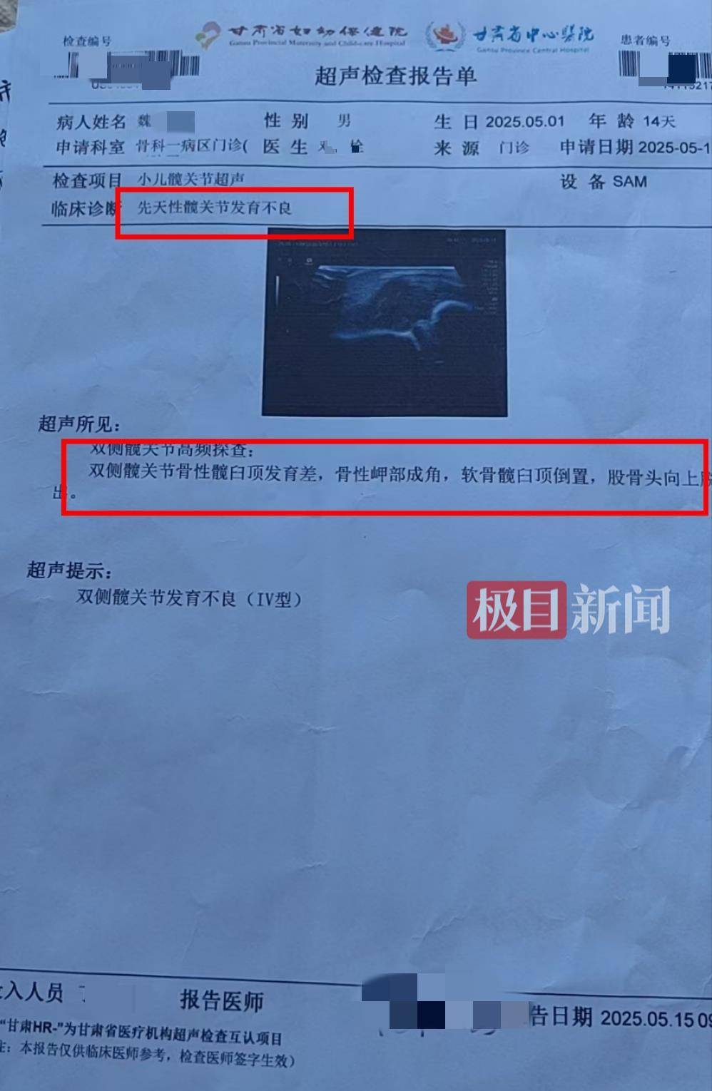 二胎出生查出先天性病癥或落下殘疾，殘疾父母稱醫(yī)院產(chǎn)檢漏檢、未盡告知義務(wù)，醫(yī)院及醫(yī)調(diào)委回應(yīng)
