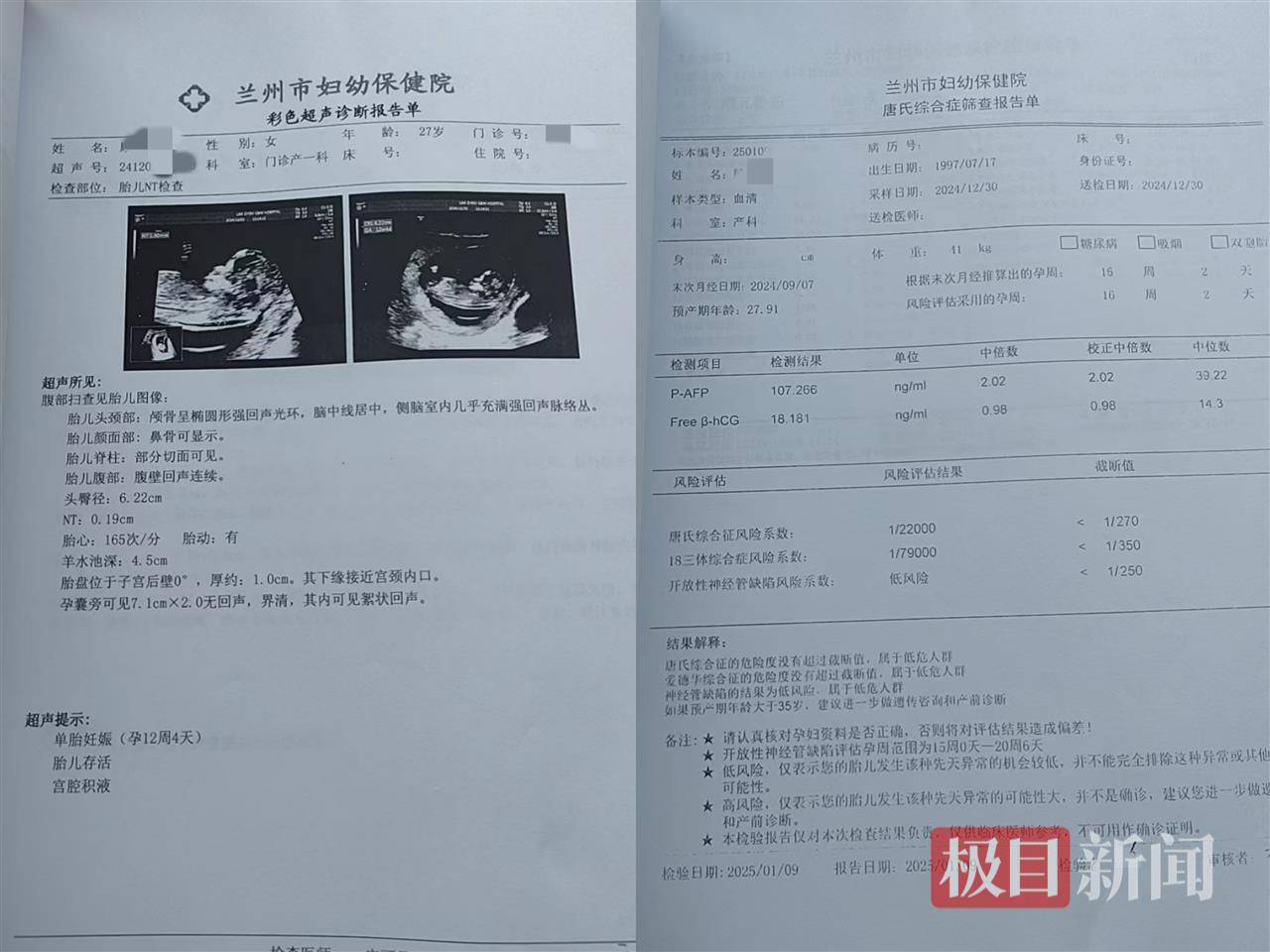 二胎出生查出先天性病癥或落下殘疾，殘疾父母稱醫(yī)院產(chǎn)檢漏檢、未盡告知義務(wù)，醫(yī)院及醫(yī)調(diào)委回應(yīng)