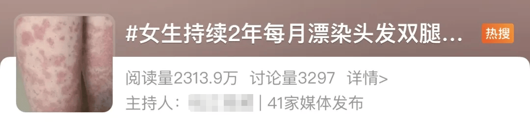 女生每月漂染頭發(fā)，全身長滿紫斑！這些美發(fā)方式可能會(huì)致癌！