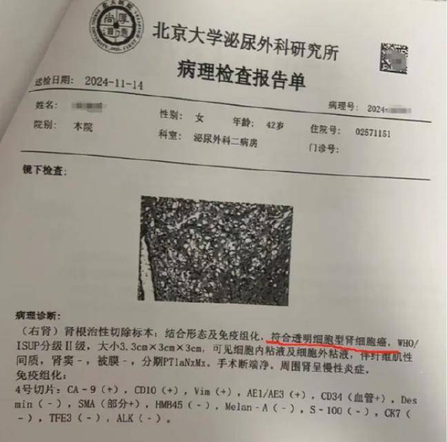 女律師十年體檢未查出癌癥，愛康國賓發(fā)布情況說明